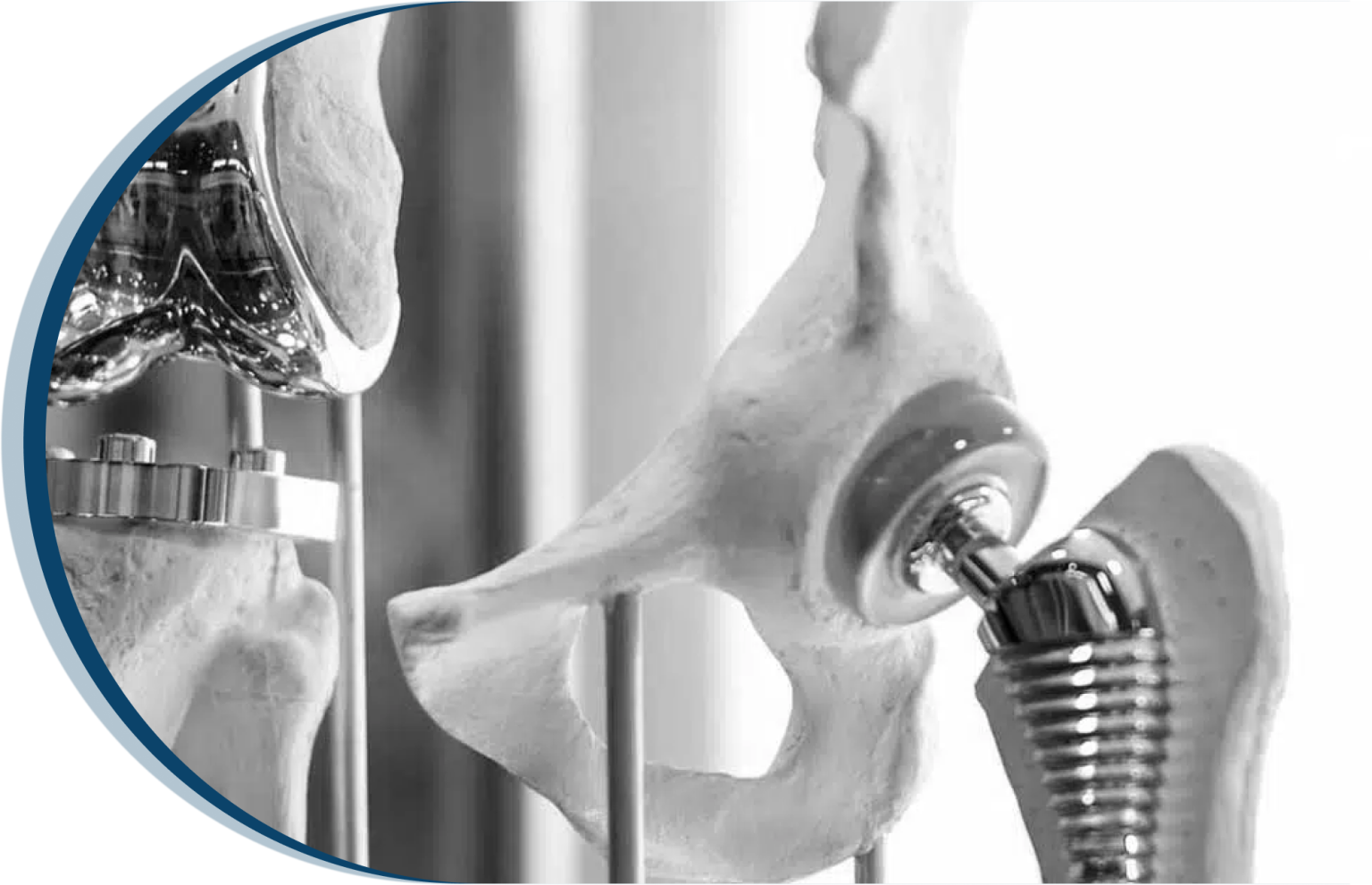 Joint Replacement & Rehabilitation Treatment Columbus, OH
